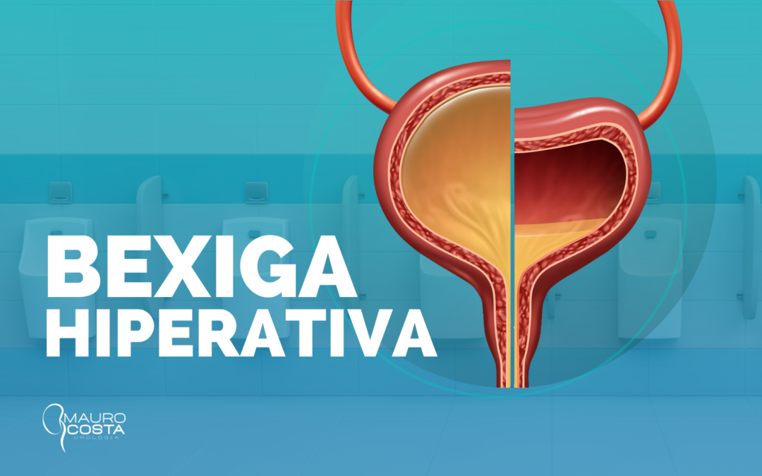 Bexiga Hiperativa